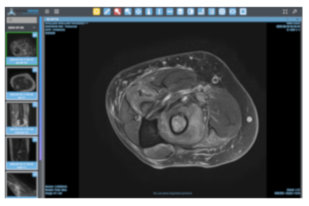 Exploración avanzada de resonancias magnéticas con el visor DICOM de ActualPACS Visor DICOM mostrando una resonancia magnética axial de extremidad en ActualPACS